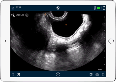 Clarius-Quick-Touch-follicles-ipad